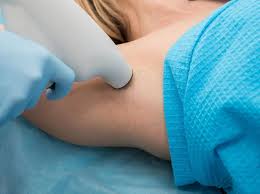 Hyperhidrosis Treatment in Abu Dhabi