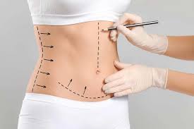 Mini Abdominoplasty in Abu Dhabi