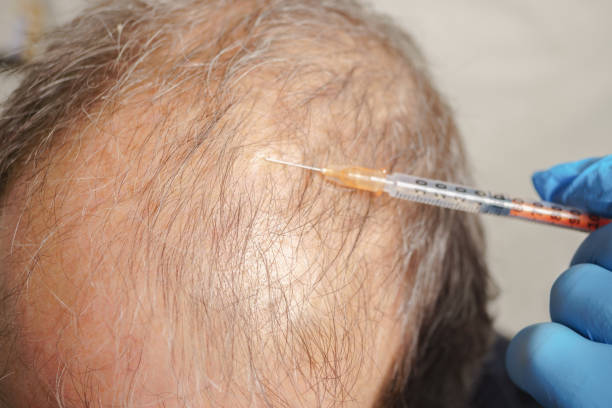 Micropigmentation