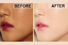 tan removal treatments in abu dhabi