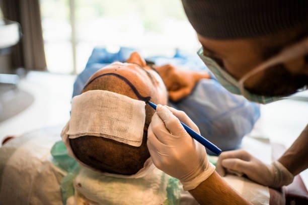 Hair Transplant in Abu Dhabi: Discover Transformative Results