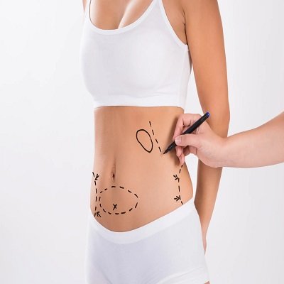 Tummy Tuck surgery in Riyadh